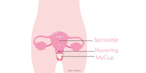 nuvaring spiraaltje met menstruatiecup