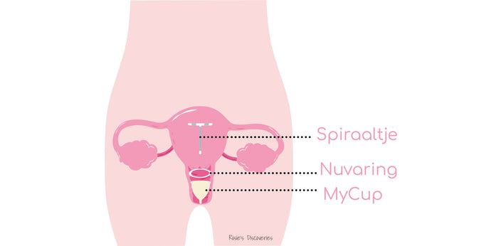IUD spiraaltje, Nuvaring en de Menstruatiecup